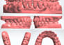 make accurate clear aligner setups with 3shape